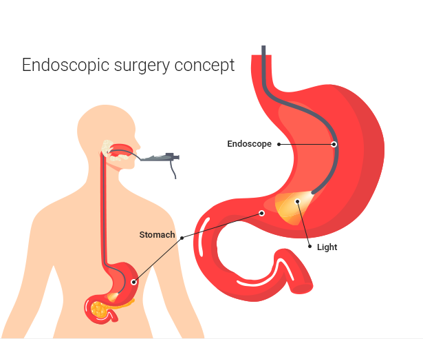 Endoscopic surgery concept